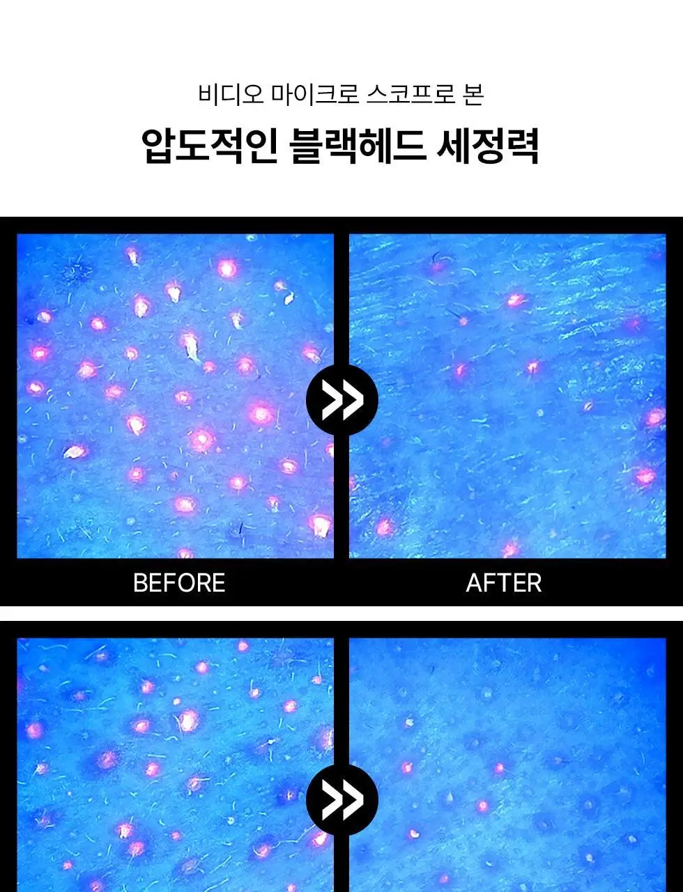 [머랭솝/팩브러쉬증정] 스킨시그널 클레이 효소클렌저 70g 팩브러쉬 증정기획 (핑크/그린) 상세페이지 32